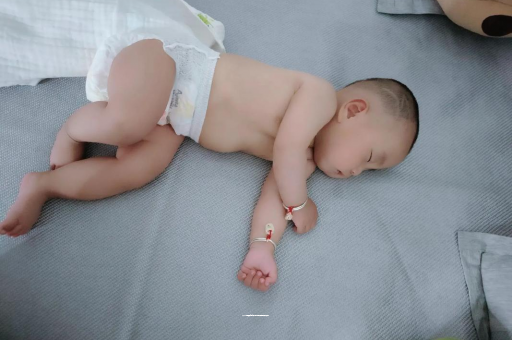 乌兰察布六个月宝宝眼睛散光